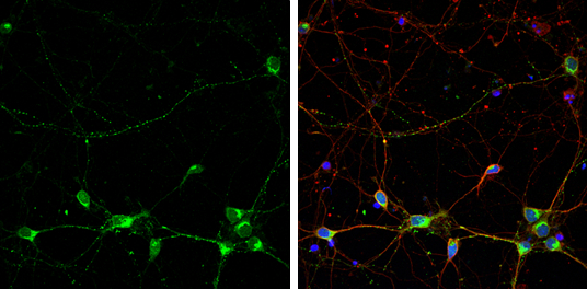 Rabphilin 3A antibody detects Rabphilin 3A protein by immunofluorescent analysis. Sample: DIV9 rat E18 primary cortical neuron cells were fixed in 4% paraformaldehyde at RT for 15 min. Green: Rabphilin 3A stained by Rabphilin 3A antibody (GTX115646) diluted at 1:500. Red: beta Tubulin 3/ Tuj1, stained by beta Tubulin 3/ Tuj1 antibody [GT1338] (GTX631831) diluted at 1:500. Blue: Fluoroshield with DAPI (GTX30920).