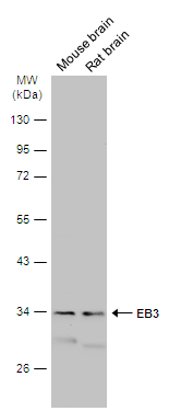 Various tissue extracts (50 μg) were separated by 10% SDS-PAGE, and the membrane was blotted with EB3 antibody (GTX115652) diluted at 1:3000. The HRP-conjugated anti-rabbit IgG antibody (GTX213110-01) was used to detect the primary antibody.