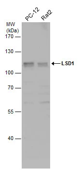 Various whole cell extracts (30 μg) were separated by 7.5% SDS-PAGE, and the membrane was blotted with LSD1 antibody (GTX115660) diluted at 1:500.