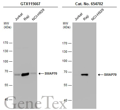 Various whole cell extracts (30 μg) were separated by 7.5% SDS-PAGE, and the membranes were blotted with SWAP70 antibody (GTX115667) diluted at 1:10000 and competitor's antibody (Cat. No. 654702) diluted at 1:1000. The HRP-conjugated anti-rabbit IgG antibody (GTX213110-01) was used to detect the primary antibody. *The competitor is not affiliated with GeneTex and does not endorse this product.