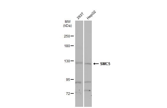 Various whole cell extracts (30 μg) were separated by 5% SDS-PAGE, and the membrane was blotted with SMC5 antibody [N2N3] (GTX115669) diluted at 1:1000. The HRP-conjugated anti-rabbit IgG antibody (GTX213110-01) was used to detect the primary antibody, and the signal was developed with Trident ECL plus-Enhanced.