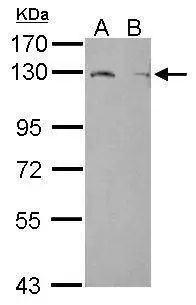 Sample (50 ug of whole cell lysate) A: mouse brown adipose B: mouse white adipose 7.5% SDS PAGE GTX115676 diluted at 1:2000