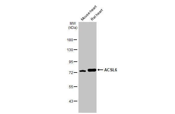 Various tissue extracts (50 μg) were separated by 7.5% SDS-PAGE, and the membrane was blotted with ACSL6 antibody (GTX115693) diluted at 1:1000. The HRP-conjugated anti-rabbit IgG antibody (GTX213110-01) was used to detect the primary antibody.