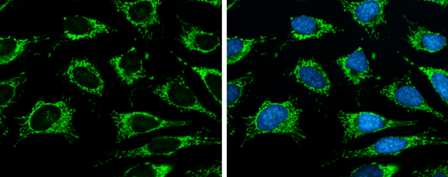 ISCU antibody [N1C3] detects ISCU protein at mitochondria by immunofluorescent analysis. Sample: HeLa cells were fixed in ice-cold MeOH for 5 min. Green: ISCU stained by ISCU antibody [N1C3] (GTX115709) diluted at 1:500. Blue: Hoechst 33342 staining.