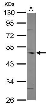 Sample (50 μg of whole cell lysate) A: mouse brain 10% SDS PAGE GTX115727 diluted at 1:500 The HRP-conjugated anti-rabbit IgG antibody (GTX213110-01) was used to detect the primary antibody.