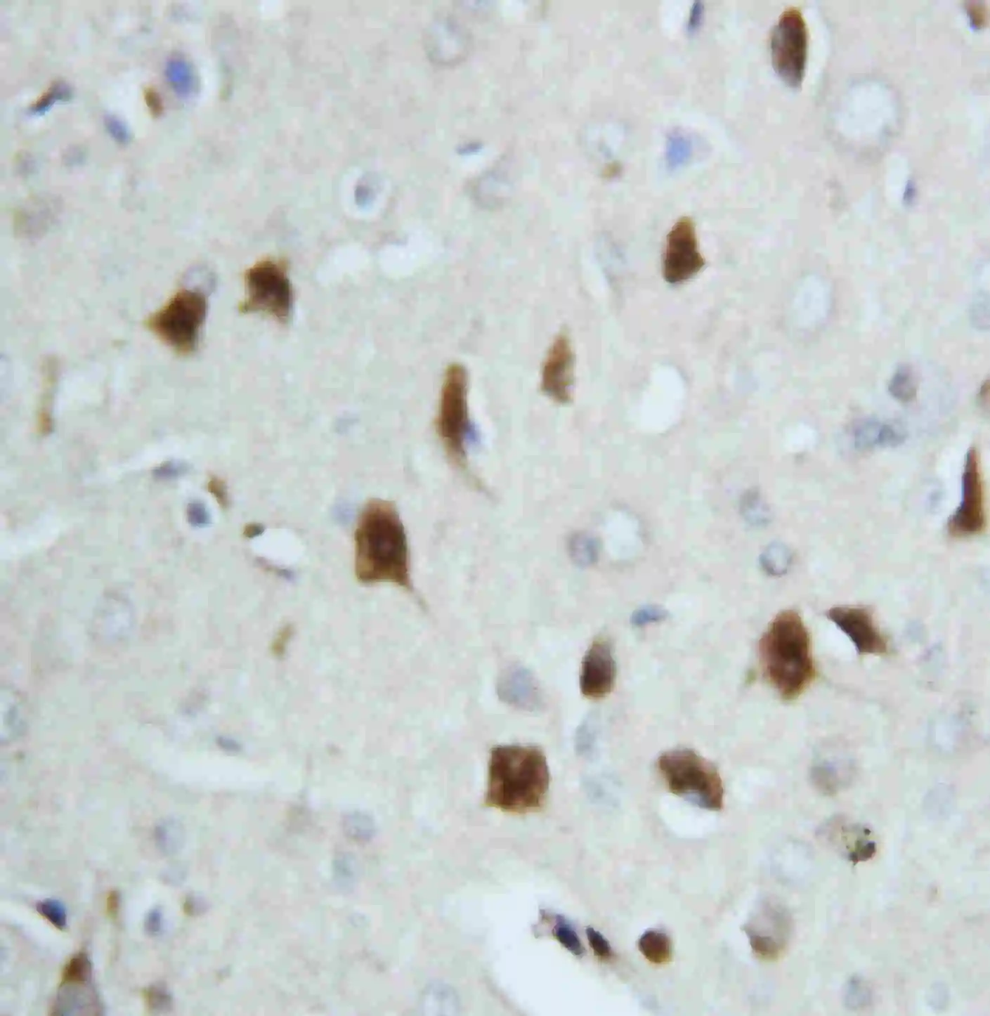 IHC-P analysis of rat brain tissue using GTX11573 Hsp70 antibody.<br>Antigen retireval : Heat mediated antigen retrieval was performed in citrate buffer (pH6, epitope retrieval solution) for 20 mins<br>Dilution : 1?g/ml