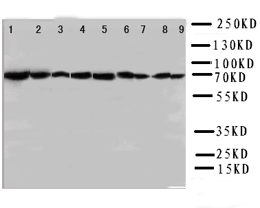 WB analysis of various samples using GTX11573 Hsp70 antibody. Lane 1 : rat testis tissue lysates Lane 2 : rat brain tissue lysates Lane 3 : rat liver tissue lysates Lane 4 : rat lung tissue lysates Lane 5 : CEM whole cell lysates Lane 6 : HeLa whole cell lysates Lane 7 : SMMC whole cell lysates Lane 8 : HT1080 whole cell lysates Lane 9 : COLO320 whole cell lysates Dilution : 0.5 microg/mL Loading : 50microg of sample under reducing conditions