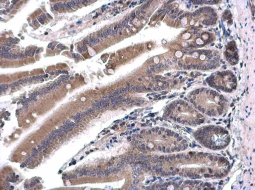 SH3BP1 antibody detects SH3BP1 protein at cytoplasm in mouse duodenum by immunohistochemical analysis. Sample: Paraffin-embedded mouse duodenum. SH3BP1 antibody (GTX115734) diluted at 1:500. 
 Antigen Retrieval: Citrate buffer, pH 6.0, 15 min
