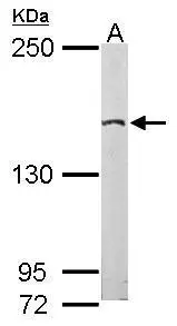 EDC4 antibody