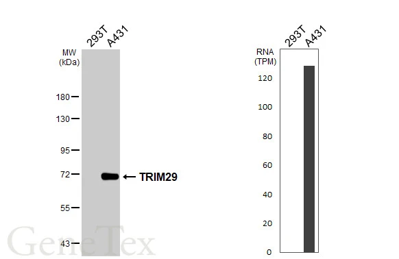 Various whole cell extracts (30 μg) were separated by 7.5% SDS-PAGE, and the membrane was blotted with TRIM29 antibody [C1C3] (GTX115749) diluted at 1:1000. The HRP-conjugated anti-rabbit IgG antibody (GTX213110-01) was used to detect the primary antibody. Corresponding RNA expression data are based on Human Protein Atlas program.