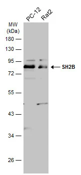 Various whole cell extracts (30 μg) were separated by 10% SDS-PAGE, and the membrane was blotted with SH2B antibody (GTX115780) diluted at 1:1000. The HRP-conjugated anti-rabbit IgG antibody (GTX213110-01) was used to detect the primary antibody.