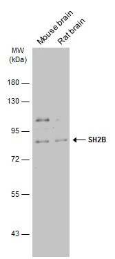 Various tissue extracts (50 μg) were separated by 7.5% SDS-PAGE, and the membrane was blotted with SH2B antibody (GTX115780) diluted at 1:2000. The HRP-conjugated anti-rabbit IgG antibody (GTX213110-01) was used to detect the primary antibody.