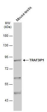 Mouse tissue extract (50 μg) was separated by 7.5% SDS-PAGE, and the membrane was blotted with TRAF3IP1 antibody [N1N2], N-term (GTX115798) diluted at 1:500. The HRP-conjugated anti-rabbit IgG antibody (GTX213110-01) was used to detect the primary antibody.