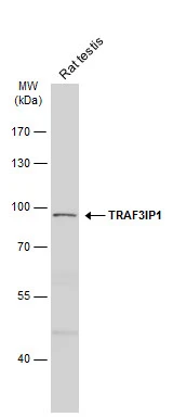 Rat tissue extract (50 μg) was separated by 7.5% SDS-PAGE, and the membrane was blotted with TRAF3IP1 antibody [N1N2], N-term (GTX115798) diluted at 1:500. The HRP-conjugated anti-rabbit IgG antibody (GTX213110-01) was used to detect the primary antibody.