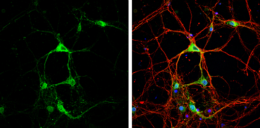 STAU2 antibody detects STAU2 protein by immunofluorescent analysis. Sample: DIV9 rat E18 primary cortical neurons were fixed in 4% paraformaldehyde at RT for 15 min. Green: STAU2 protein stained by STAU2 antibody (GTX115836) diluted at 1:500. Red: beta Tubulin 3/ Tuj1, stained by beta Tubulin 3/ Tuj1 antibody [GT886] (GTX631830) diluted at 1:500. Blue: Fluoroshield with DAPI (GTX30920).