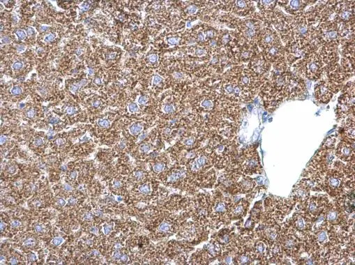 PSAT1 antibody [N3C3] detects PSAT1 protein at cytoplasm on mouse liver by immunohistochemical analysis. Sample: Paraffin-embedded mouse liver. PSAT1 antibody [N3C3] (GTX115909) diluted at 1:500. 
 Antigen Retrieval: Trilogy? (EDTA based, pH 8.0) buffer, 15min