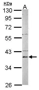 Sample (50 μg of whole cell lysate) A: mouse brain 10% SDS PAGE GTX115909 diluted at 1:1000 The HRP-conjugated anti-rabbit IgG antibody (GTX213110-01) was used to detect the primary antibody.