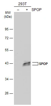 Non-transfected (–) and transfected (+) 293T whole cell extracts (30 μg) were separated by 10% SDS-PAGE, and the membrane was blotted with SPOP antibody [N3C3] (GTX115917) diluted at 1:1000. The HRP-conjugated anti-rabbit IgG antibody (GTX213110-01) was used to detect the primary antibody.