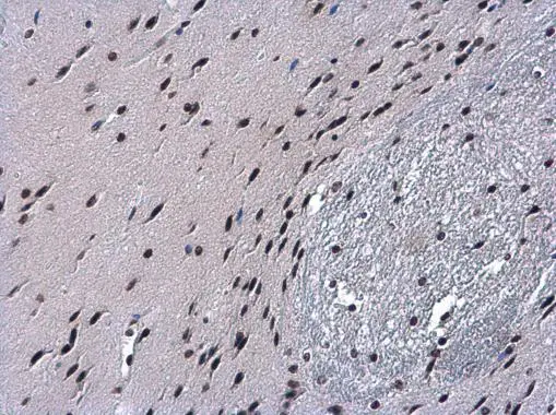 Histone H2B antibody detects Histone H2B protein at nucleus in mouse middle brain by immunohistochemical analysis. Sample: Paraffin-embedded mouse middle brain. Histone H2B antibody (GTX115955) diluted at 1:500.
Antigen Retrieval: Citrate buffer, pH 6.0, 15 min Histone H2B antibody detects Histone H2B protein at nucleus in mouse middle brain by immunohistochemical analysis. Sample: Paraffin-embedded mouse middle brain. Histone H2B antibody (GTX115955) diluted at 1:500.
Antigen Retrieval: Citrate buffer, pH 6.0, 15 min