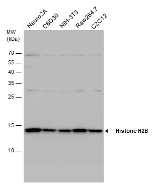 Various whole cell extracts (30 μg) were separated by 15% SDS-PAGE, and the membrane was blotted with Histone H2B antibody (GTX115955) diluted at 1:5000. The HRP-conjugated anti-rabbit IgG antibody (GTX213110-01) was used to detect the primary antibody. Various whole cell extracts (30 μg) were separated by 15% SDS-PAGE, and the membrane was blotted with Histone H2B antibody (GTX115955) diluted at 1:5000. The HRP-conjugated anti-rabbit IgG antibody (GTX213110-01) was used to detect the primary antibody.