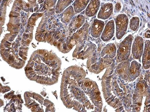 PRMT5 antibody [N1N3] detects PRMT5 protein at cytosol on mouse intestine by immunohistochemical analysis. Sample: Paraffin-embedded mouse intestine. PRMT5 antibody [N1N3] (GTX115994) dilution: 1:500. 
 Antigen Retrieval: Trilogy? (EDTA based, pH 8.0) buffer, 15min