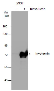Non-transfected (–) and transfected (+) 293T whole cell extracts (30 μg) were separated by 7.5% SDS-PAGE, and the membrane was blotted with Involucrin antibody [N1N2], N-term (GTX116012) diluted at 1:1000. The HRP-conjugated anti-rabbit IgG antibody (GTX213110-01) was used to detect the primary antibody.