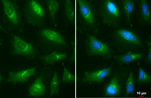Presenilin 1 antibody [C1C2], Internal detects Presenilin 1 protein at Golgi apparatus and endoplasmic reticulum by immunofluorescent analysis. Sample: HeLa cells were fixed in ice-cold MeOH for 5 min. Green: Presenilin 1 stained by Presenilin 1 antibody [C1C2], Internal (GTX116016) diluted at 1:500. Blue: Hoechst 33342 staining. Scale bar= 10 μm.