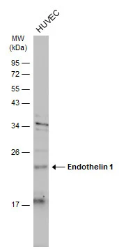 Whole cell extract (30 ug) was separated by 12% SDS-PAGE,and the membrane was blotted with Endothelin 1 antibody [C1C3] (GTX116033) diluted at 1:500. The HRP-conjugated anti-rabbit IgG antibody (GTX213110-01) was used to detect the primary antibody.