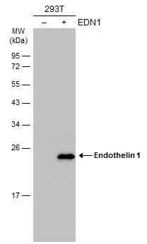 Non-transfected (–) and transfected (+) 293T whole cell extracts (30 μg) were separated by 12% SDS-PAGE, and the membrane was blotted with Endothelin 1 antibody [C1C3] (GTX116033) diluted at 1:5000. The HRP-conjugated anti-rabbit IgG antibody (GTX213110-01) was used to detect the primary antibody.