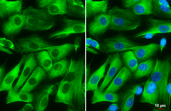 Nestin antibody detects Nestin protein at cytoskeleton by immunofluorescent analysis. Sample: SK-N-SH cells were fixed in 4% paraformaldehyde at RT for 15 min. Green: Nestin stained by Nestin antibody (GTX116066) diluted at 1:500. Blue: Hoechst 33342 staining. Scale bar= 10 μm.