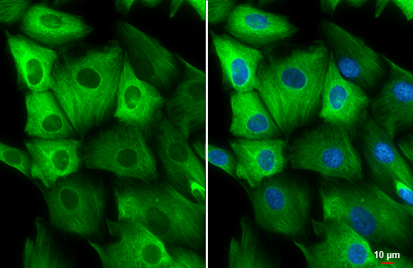 Nestin antibody detects Nestin protein at cytoskeleton by immunofluorescent analysis. Sample: SK-N-SH cells were fixed in 4% paraformaldehyde at RT for 15 min. Green: Nestin stained by Nestin antibody (GTX116066) diluted at 1:500. Blue: Hoechst 33342 staining. Scale bar= 10 μm.