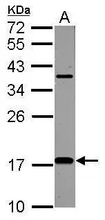 Sample (50 ug of whole cell lysate) A: Rat brain 12% SDS PAGE GTX116080 diluted at 1:1000
