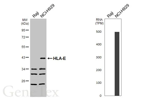 Various whole cell extracts (30 μg) were separated by 10% SDS-PAGE, and the membrane was blotted with HLA-E antibody (GTX116088) diluted at 1:1000. The HRP-conjugated anti-rabbit IgG antibody (GTX213110-01) was used to detect the primary antibody, and the signal was developed with Trident ECL plus-Enhanced. Corresponding RNA expression data for the same cell lines are based on Human Protein Atlas program.