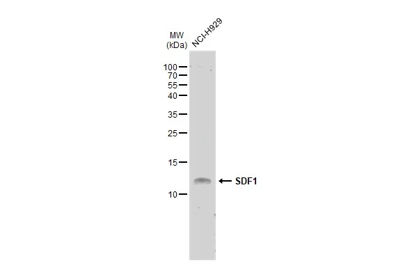 Whole cell extract (30 μg) was separated by 15% SDS-PAGE, and the membrane was blotted with SDF1 antibody [N1C3] (GTX116092) diluted at 1:1000. The HRP-conjugated anti-rabbit IgG antibody (GTX213110-01) was used to detect the primary antibody.