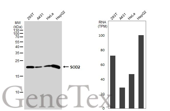 Various whole cell extracts (30 μg) were separated by 15% SDS-PAGE, and the membrane was blotted with SOD2 antibody (GTX116093) diluted at 1:1000. The HRP-conjugated anti-rabbit IgG antibody (GTX213110-01) was used to detect the primary antibody. Corresponding RNA expression data for the same cell lines are based on Human Protein Atlas program.