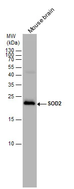 SOD2 antibody detects SOD2 protein by western blot analysis. Mouse tissue extracts (50 μg) was separated by 15% SDS-PAGE, and the membrane was blotted with SOD2 antibody (GTX116093) diluted by 1:1000. The HRP-conjugated anti-rabbit IgG antibody (GTX213110-01) was used to detect the primary antibody.