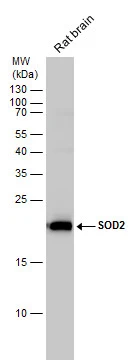 SOD2 antibody detects SOD2 protein by western blot analysis. Rat tissue extracts (50 μg) was separated by 15% SDS-PAGE, and the membrane was blotted with SOD2 antibody (GTX116093) diluted by 1:2500. The HRP-conjugated anti-rabbit IgG antibody (GTX213110-01) was used to detect the primary antibody.