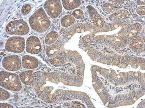 HEBP1 antibody [N1C3]