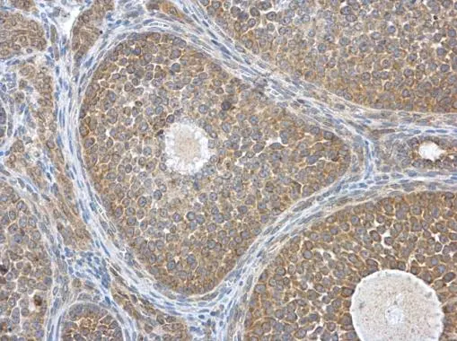 HEBP1 antibody [N1C3]