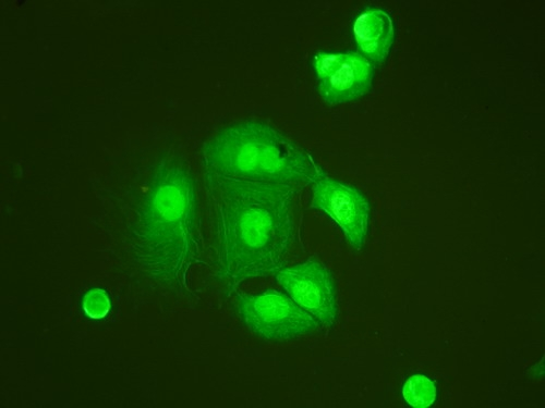 ICC/IF analysis of HeLa cell using GTX11617 TNFAIP1 antibody. ICC/IF analysis of HeLa cell using GTX11617 TNFAIP1 antibody.