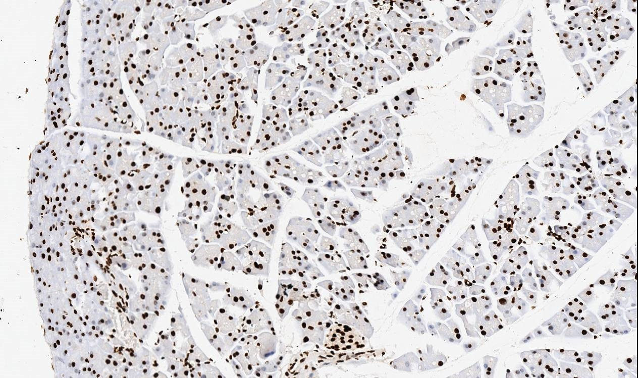 IHC-P analysis of mouse pancreas tissue using GTX11617 TNFAIP1 antibody. Antigen retireval : Heat mediated antigen retrieval was performed in citrate buffer (pH6, epitope retrieval solution) for 20 mins Dilution : 1microg/ml