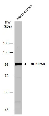 NCKIPSD antibody [C1C3]