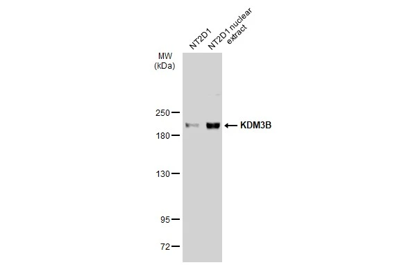 NT2D1 whole cell and nuclear extracts (30 μg) were separated by 5% SDS-PAGE, and the membrane was blotted with KDM3B antibody [C2C3], C-term (GTX116198) diluted at 1:1000. The HRP-conjugated anti-rabbit IgG antibody (GTX213110-01) was used to detect the primary antibody.