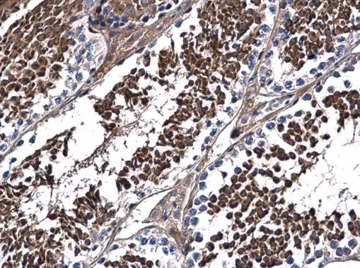 DNALI1 antibody detects DNALI1 protein at cytoplasm in mouse testis by immunohistochemical analysis. Sample: Paraffin-embedded mouse testis. DNALI1 antibody (GTX116217) diluted at 1:500.
Antigen Retrieval: Citrate buffer, pH 6.0, 15 min DNALI1 antibody detects DNALI1 protein at cytoplasm in mouse testis by immunohistochemical analysis. Sample: Paraffin-embedded mouse testis. DNALI1 antibody (GTX116217) diluted at 1:500.
Antigen Retrieval: Citrate buffer, pH 6.0, 15 min