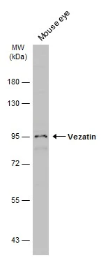 Mouse tissue extract (50 μg) was separated by 7.5% SDS-PAGE, and the membrane was blotted with Vezatin antibody (GTX116240) diluted at 1:3000. The HRP-conjugated anti-rabbit IgG antibody (GTX213110-01) was used to detect the primary antibody.