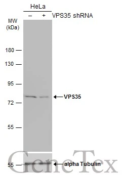Non-transfected (–) and transfected (+) HeLa whole cell extracts (30 μg) were separated by 7.5% SDS-PAGE, and the membrane was blotted with VPS35 antibody (GTX116260) diluted at 1:1000. The HRP-conjugated anti-rabbit IgG antibody (GTX213110-01) was used to detect the primary antibody.