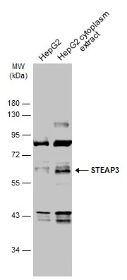HepG2 whole cell and cytoplasm extracts (30 μg) were separated by 10% SDS-PAGE, and the membrane was blotted with STEAP3 antibody (GTX116308) diluted at 1:1000. The HRP-conjugated anti-rabbit IgG antibody (GTX213110-01) was used to detect the primary antibody.