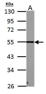 PHF10 antibody detects PHF10 protein by western blot analysis. A.50 μg mouse colon lysate/extract 10% SDS-PAGE PHF10 antibody (GTX116314) dilution: 1:1000 The HRP-conjugated anti-rabbit IgG antibody (GTX213110-01) was used to detect the primary antibody.