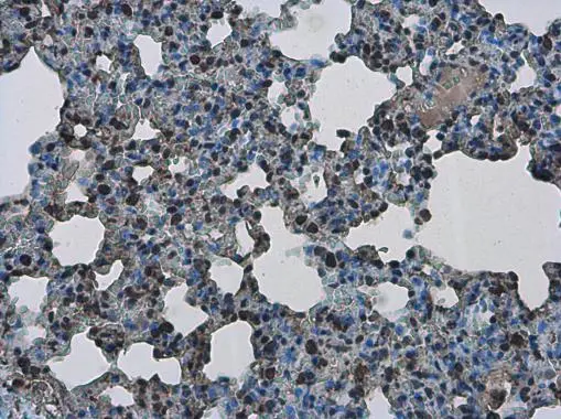 PHF10 antibody detects PHF10 protein at nucleus in rat lung by immunohistochemical analysis. Sample: Paraffin-embedded rat lung. PHF10 antibody (GTX116314) diluted at 1:500. 
 Antigen Retrieval: Citrate buffer, pH 6.0, 15 min