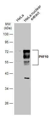 HeLa whole cell and nuclear extracts (30 μg) were separated by 10% SDS-PAGE, and the membrane was blotted with PHF10 antibody (GTX116314) diluted at 1:1000. The HRP-conjugated anti-rabbit IgG antibody (GTX213110-01) was used to detect the primary antibody.